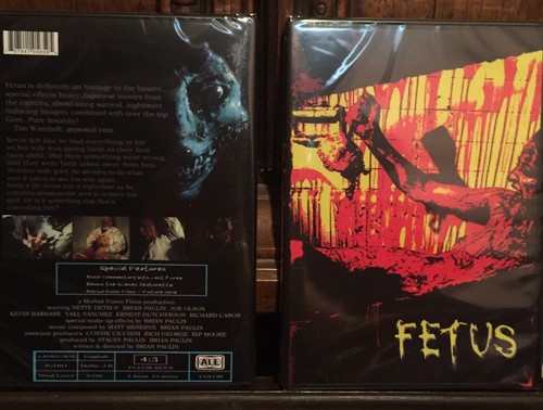 Fetus morbid vision - vision, films